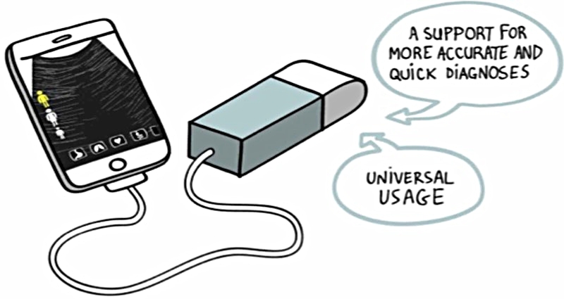 Picture from EchOpen, www.echopen.org